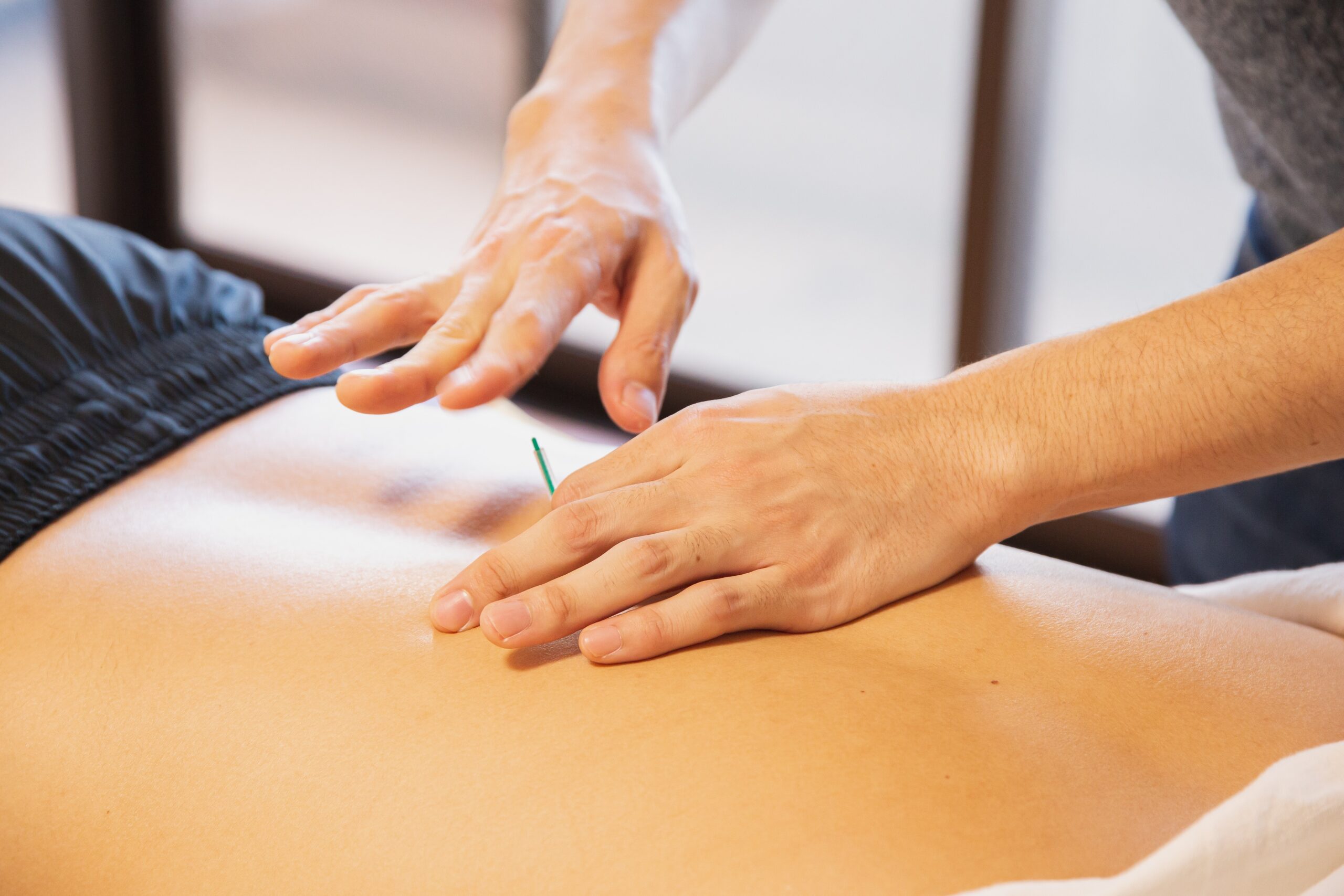 A patient receiving acupuncture treatment